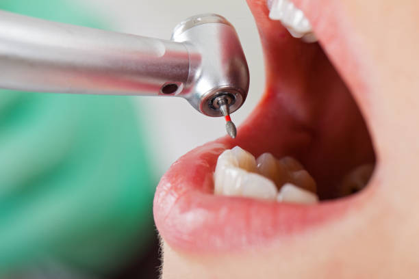 Best Emergency Treatment for Dental Infections or Abscesses in Dalton Gardens, ID
